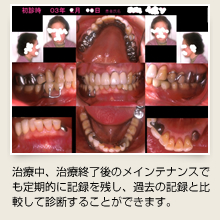 幡ヶ谷（新宿・渋谷近く）の歯医者、山田歯科医院の歯科総合検査